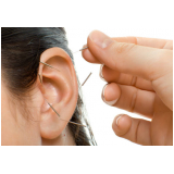 acupuntura na orelha Jardim das Paineiras