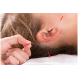 acupuntura para ansiedade Nova Campinas