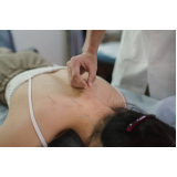 clinica que faz acupuntura para dor de cabeça Jardim Miranda